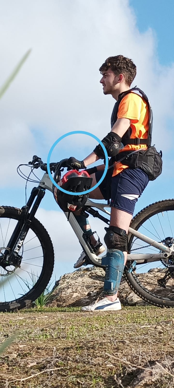 Sobreflexión de la muñeca