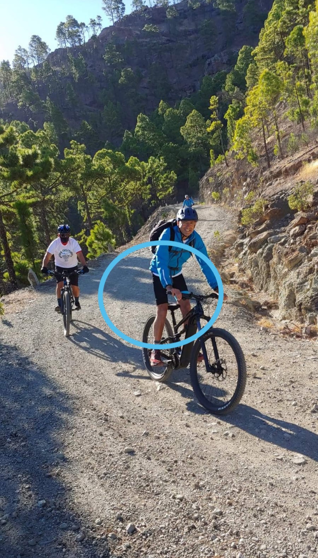 Error cadera adelantada 